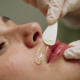 How to Reduce Skin Irritation After Upper Lip Hair Removal