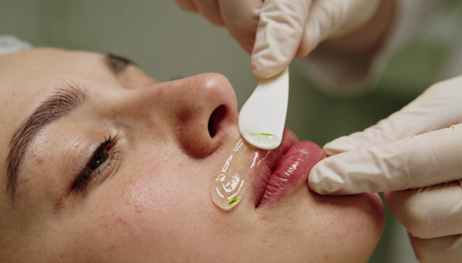How to Reduce Skin Irritation After Upper Lip Hair Removal